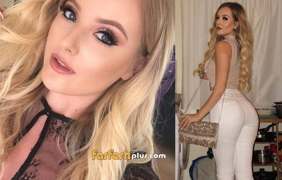 عارضة ازياء شهيرة تواجه خطر بتر قدمها بسبب حذاء... وهذه التفاصيل صورة رقم 1