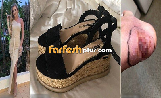 عارضة ازياء شهيرة تواجه خطر بتر قدمها بسبب حذاء... وهذه التفاصيل صورة رقم 10