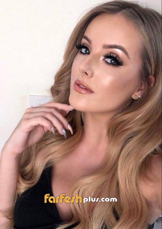 عارضة ازياء شهيرة تواجه خطر بتر قدمها بسبب حذاء... وهذه التفاصيل صورة رقم 3