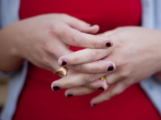 6 علامات لتساقط الشعر قد تشير إلى مشاكل صحية وأمراض خطيرة صورة رقم 5 6 علامات لتساقط الشعر قد تشير إلى مشاكل صحية وأمراض خطيرة صورة رقم 5