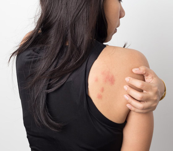 6 علامات لتساقط الشعر قد تشير إلى مشاكل صحية وأمراض خطيرة صورة رقم 7 6 علامات لتساقط الشعر قد تشير إلى مشاكل صحية وأمراض خطيرة صورة رقم 7