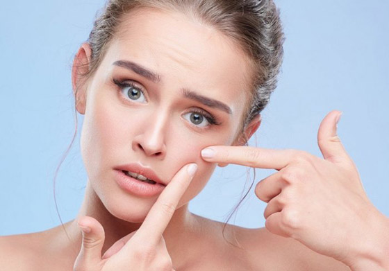 عادات يومية يمكن أن تمنع ظهور حب الشباب صورة رقم 1