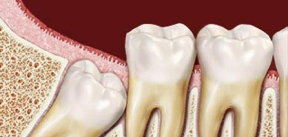 أعضاء في جسمنا يمكن العيش من دونها صورة رقم 3