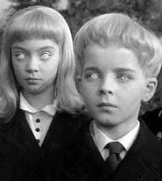 أطفال ميريديث: أربعة أطفال حيّروا الطب والعلم بمرضهم الغريب وعجز تفسيره! صورة رقم 3