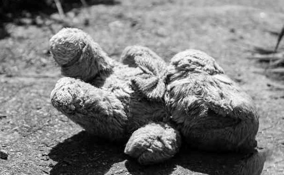 أطفال ميريديث: أربعة أطفال حيّروا الطب والعلم بمرضهم الغريب وعجز تفسيره! صورة رقم 10