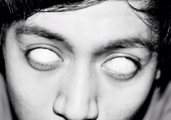 أطفال ميريديث: أربعة أطفال حيّروا الطب والعلم بمرضهم الغريب وعجز تفسيره! صورة رقم 11