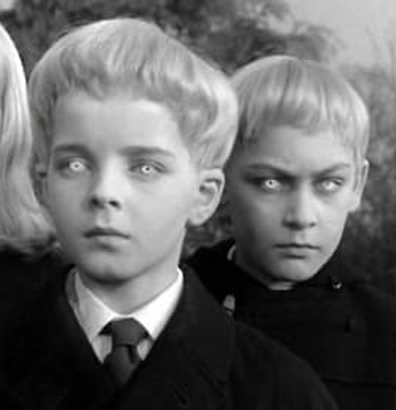 أطفال ميريديث: أربعة أطفال حيّروا الطب والعلم بمرضهم الغريب وعجز تفسيره! صورة رقم 8