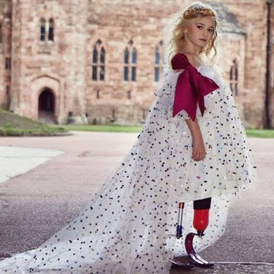 صور: طفلة مبتورة الساقين تشارك في عرض أزياء بأسبوع الموضة صورة رقم 5