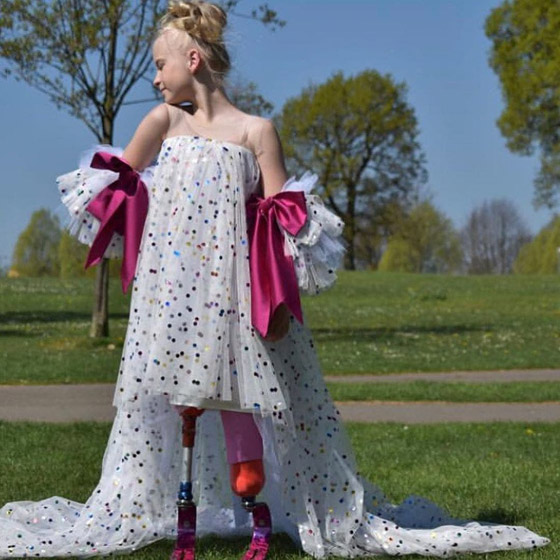 صور: طفلة مبتورة الساقين تشارك في عرض أزياء بأسبوع الموضة صورة رقم 6