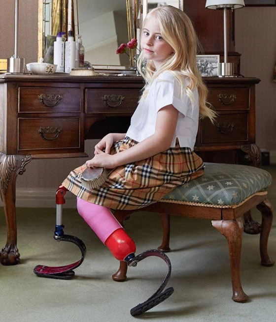 صور: طفلة مبتورة الساقين تشارك في عرض أزياء بأسبوع الموضة صورة رقم 7