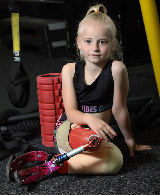 صور: طفلة مبتورة الساقين تشارك في عرض أزياء بأسبوع الموضة صورة رقم 9