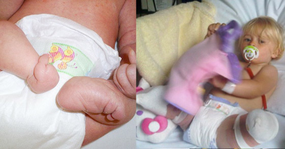 صور: طفلة مبتورة الساقين تشارك في عرض أزياء بأسبوع الموضة صورة رقم 10