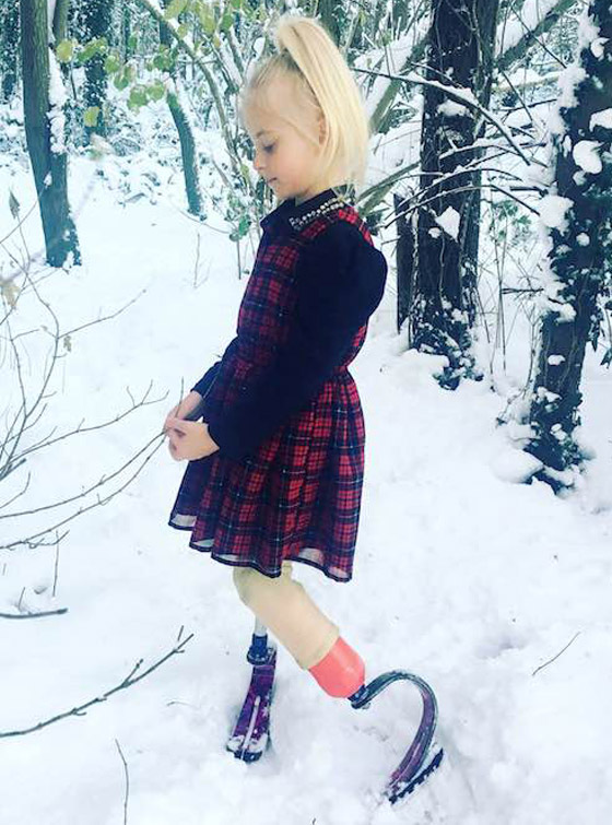 صور: طفلة مبتورة الساقين تشارك في عرض أزياء بأسبوع الموضة صورة رقم 11