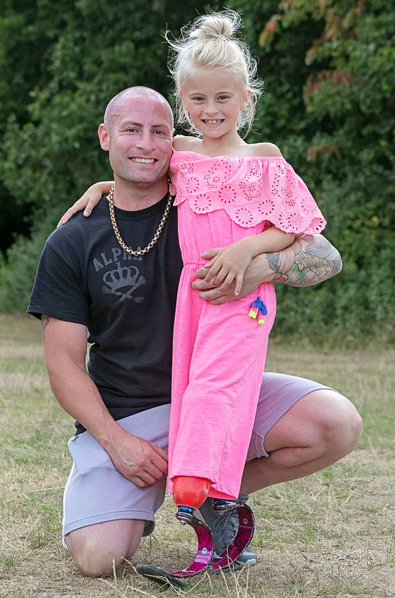 صور: طفلة مبتورة الساقين تشارك في عرض أزياء بأسبوع الموضة صورة رقم 3