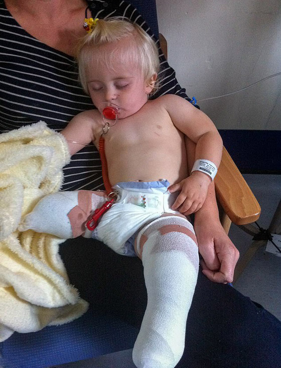 صور: طفلة مبتورة الساقين تشارك في عرض أزياء بأسبوع الموضة صورة رقم 13