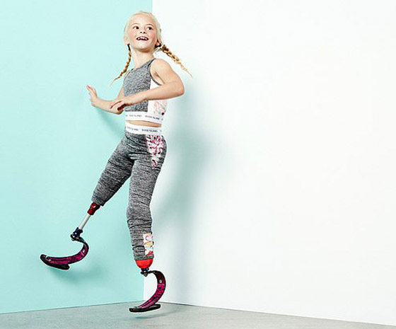 صور: طفلة مبتورة الساقين تشارك في عرض أزياء بأسبوع الموضة صورة رقم 14