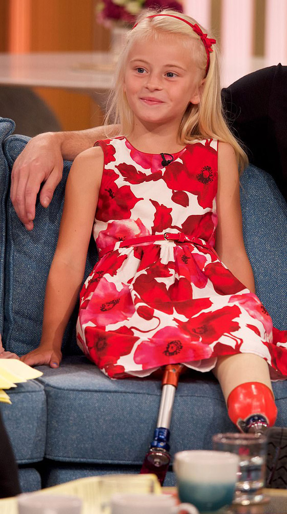 صور: طفلة مبتورة الساقين تشارك في عرض أزياء بأسبوع الموضة صورة رقم 15