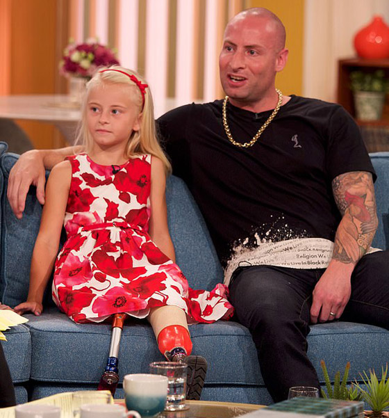 صور: طفلة مبتورة الساقين تشارك في عرض أزياء بأسبوع الموضة صورة رقم 16