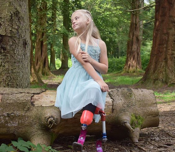 صور: طفلة مبتورة الساقين تشارك في عرض أزياء بأسبوع الموضة صورة رقم 18