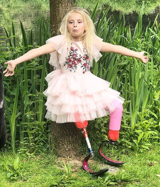 صور: طفلة مبتورة الساقين تشارك في عرض أزياء بأسبوع الموضة صورة رقم 21