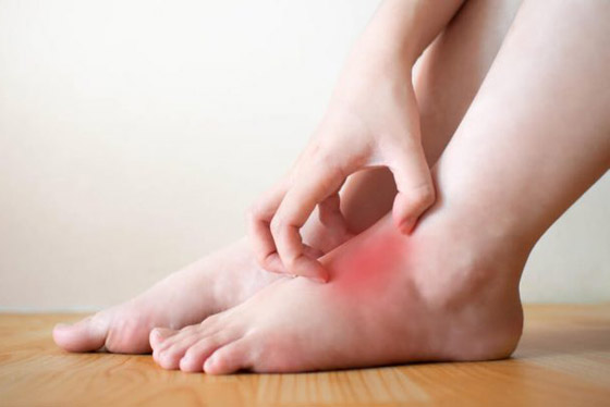 9 أعراض مبكرة لتشخيص مرض السكري صورة رقم 7