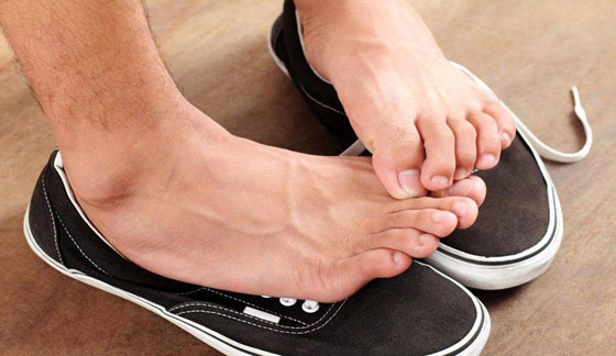 منعا للإحراج.. هكذا تتخلص من رائحة القدمين والحذاء الكريهة صورة رقم 2
