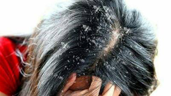 4 استخدامات جمالية للملح لا يعرفها كثيرون صورة رقم 1 4 استخدامات جمالية للملح لا يعرفها كثيرون صورة رقم 1