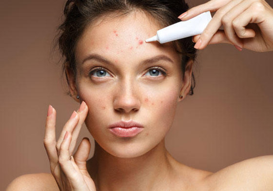 الطريقة المثلى لمعالجة حب الشباب صورة رقم 11