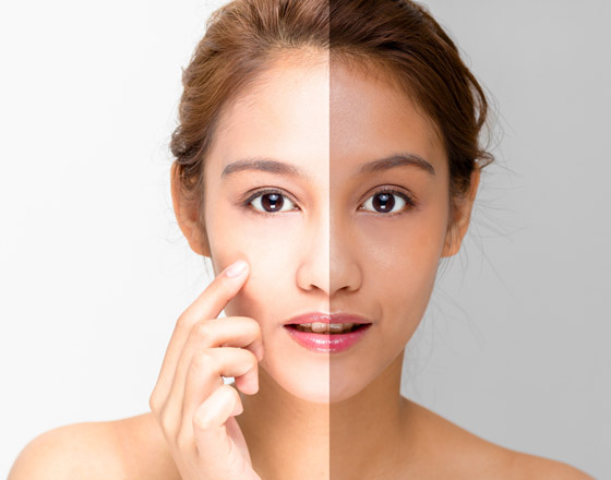 أفضل الخلطات الطبيعية لتبييض البشرة ونصائح مهمة لاستعادة بريق الوجه صورة رقم 5