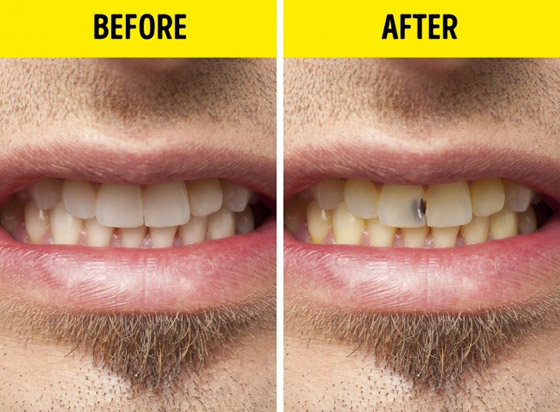 9 عادات يومية من الأفضل التخلص منها للحفاظ على الجسم والصحة صورة رقم 4