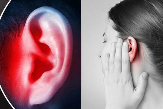 ليس كما تظن.. احمرار الأذن حالة طبية يجب علاجها.. وهذه الأسباب! صورة رقم 4 ليس كما تظن.. احمرار الأذن حالة طبية يجب علاجها.. وهذه الأسباب! صورة رقم 4