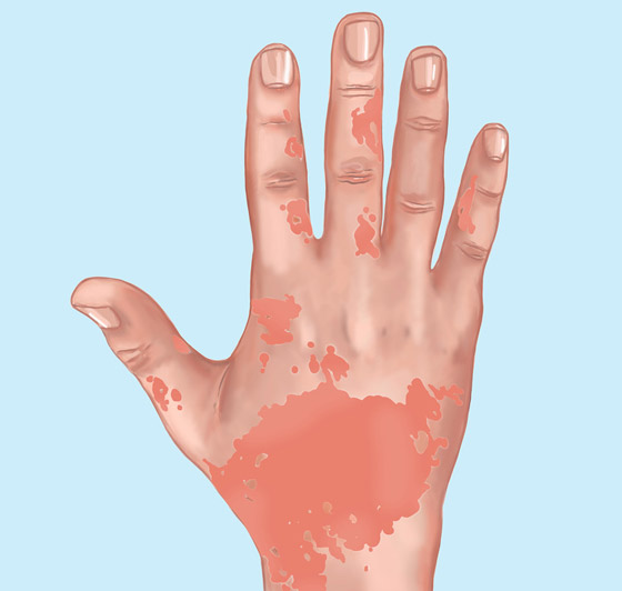 10 علامات تؤكد أن الجسم مغمور بالسموم صورة رقم 5