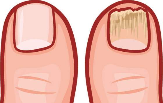 10 علامات تؤكد أن الجسم مغمور بالسموم صورة رقم 9