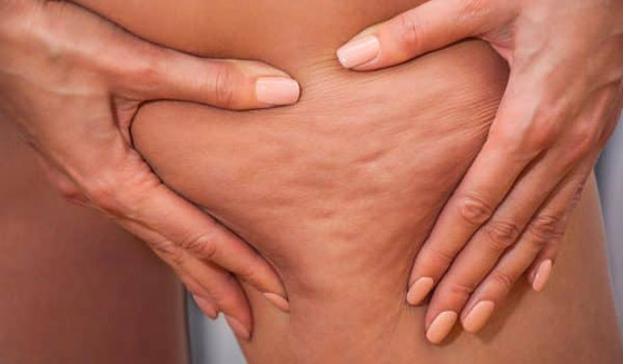 استخدامات جمالية مذهلة لزيت جوز الهند صورة رقم 5 استخدامات جمالية مذهلة لزيت جوز الهند صورة رقم 5