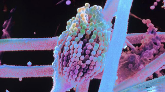 أبرز الأسباب لانتشار الجراثيم في الغذاء! صورة رقم 1 أبرز الأسباب لانتشار الجراثيم في الغذاء! صورة رقم 1