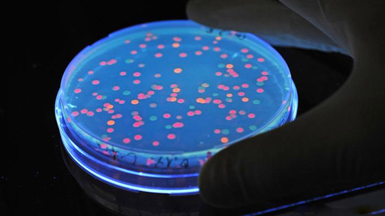 أبرز الأسباب لانتشار الجراثيم في الغذاء! صورة رقم 3 أبرز الأسباب لانتشار الجراثيم في الغذاء! صورة رقم 3