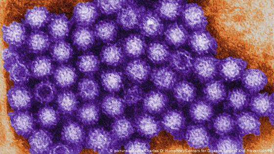 أبرز الأسباب لانتشار الجراثيم في الغذاء! صورة رقم 7 أبرز الأسباب لانتشار الجراثيم في الغذاء! صورة رقم 7