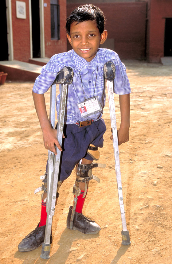 في اليوم العالمي لشلل الأطفال.. مسؤولو الصحة يعلنون انتصارا في مكافحته صورة رقم 13