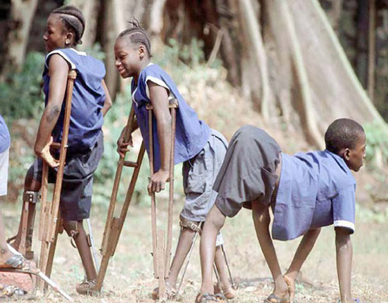 في اليوم العالمي لشلل الأطفال.. مسؤولو الصحة يعلنون انتصارا في مكافحته صورة رقم 15