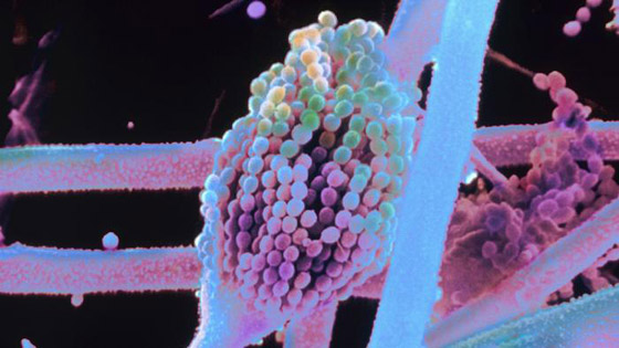 تعرفوا إلى أبرز أسباب انتشار الجراثيم (العدو الخفي) في الطعام والغذاء! صورة رقم 1 تعرفوا إلى أبرز أسباب انتشار الجراثيم (العدو الخفي) في الطعام والغذاء! صورة رقم 1