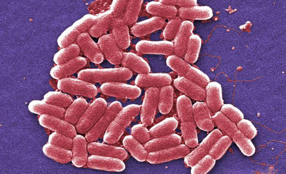 تعرفوا إلى أبرز أسباب انتشار الجراثيم (العدو الخفي) في الطعام والغذاء! صورة رقم 4 تعرفوا إلى أبرز أسباب انتشار الجراثيم (العدو الخفي) في الطعام والغذاء! صورة رقم 4