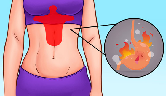 كيف يكشف موقع الألم بالبطن عن المشكلات الصحية لديك؟ وما العلاج؟ صورة رقم 2