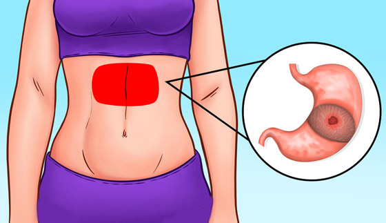 كيف يكشف موقع الألم بالبطن عن المشكلات الصحية لديك؟ وما العلاج؟ صورة رقم 3