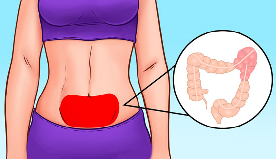 كيف يكشف موقع الألم بالبطن عن المشكلات الصحية لديك؟ وما العلاج؟ صورة رقم 4