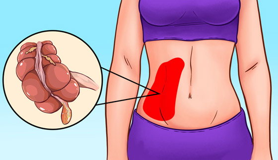 كيف يكشف موقع الألم بالبطن عن المشكلات الصحية لديك؟ وما العلاج؟ صورة رقم 9