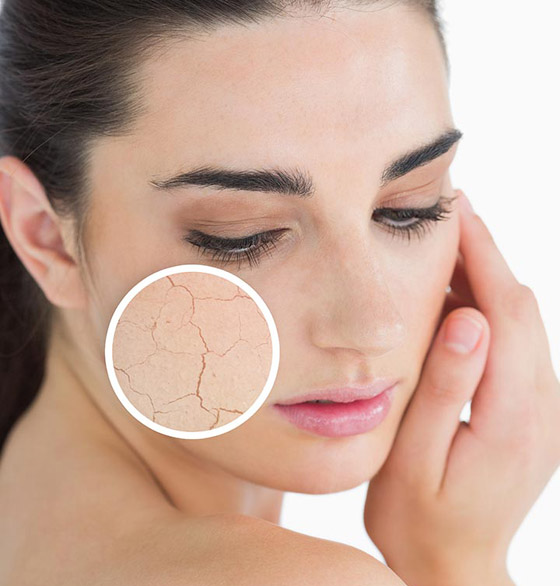 إليكم 7 علامات تدل على الشيخوخة المبكرة وطرق مكافحة كل منها! صورة رقم 2