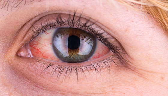 إليكم 7 علامات تدل على الشيخوخة المبكرة وطرق مكافحة كل منها! صورة رقم 4