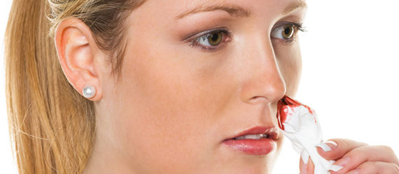 نزيف الأنف المفاجئ.. ما هي أسبابه وطريقة علاجه؟ صورة رقم 5