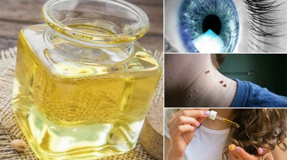 تعرفوا إلى الفوائد الطبية لزيت الخروع وأهم مشاكل الشعر التي يعالجها صورة رقم 9 تعرفوا إلى الفوائد الطبية لزيت الخروع وأهم مشاكل الشعر التي يعالجها صورة رقم 9