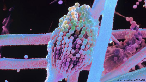 أبرز خمسة أسباب لانتشار الجراثيم في الغذاء!  صورة رقم 1